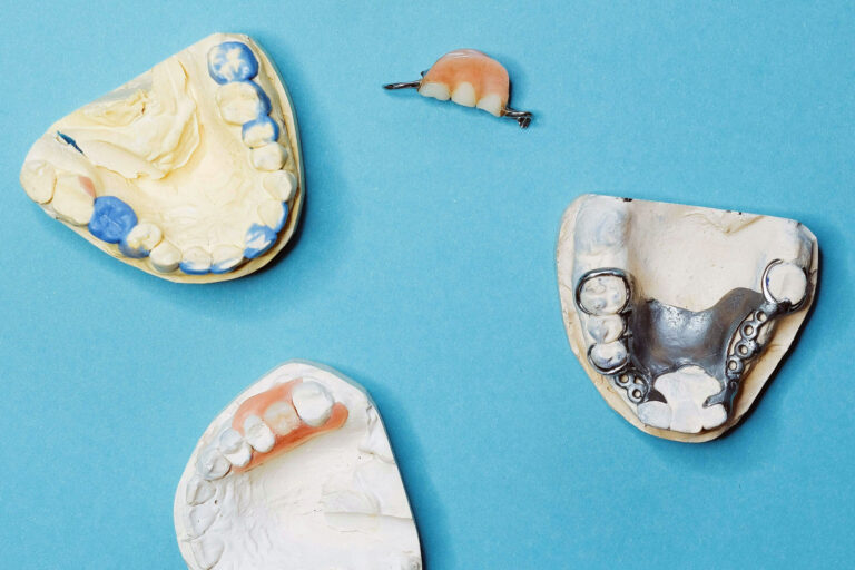 Zahnbrücke Implantat